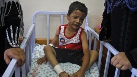 Three Brothers Slowly Recover from Shrapnel Burns, Unaware of Their Mother’s Death