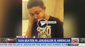 Teen Beaten by Israeli Police Meets at White House as He Prepares to Return to Jerusalem